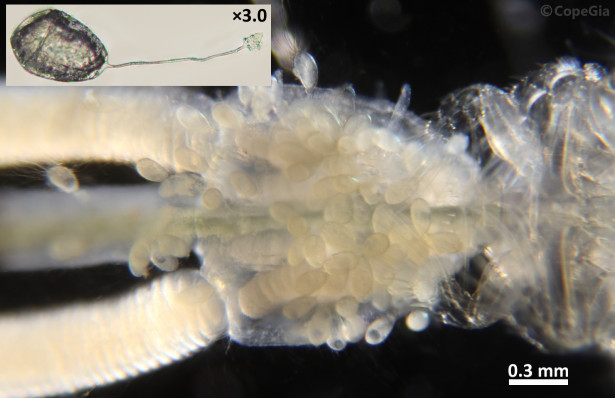 T. akajeiiの生殖節に付着している単生類U. australisの卵とその拡大