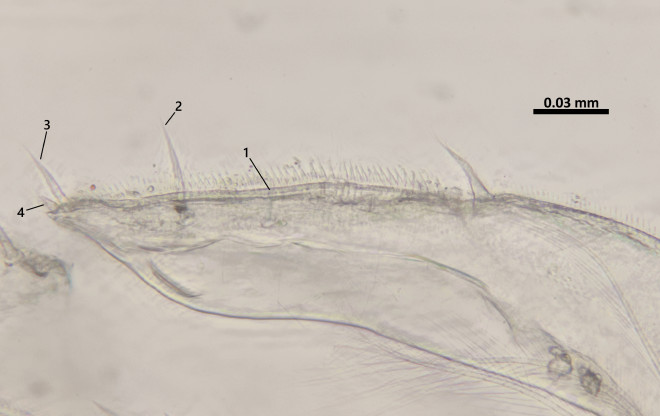 Porcellidium kiiroumの第5胸脚