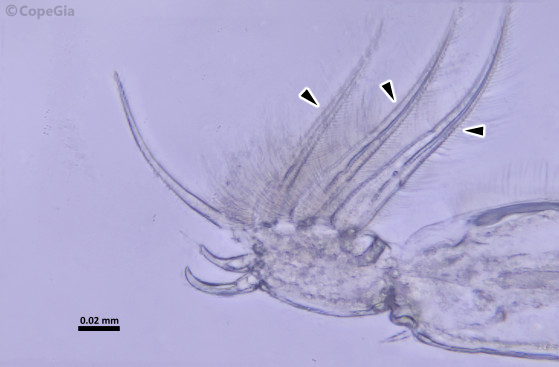 Caligus undulatus雌の第1胸脚末端