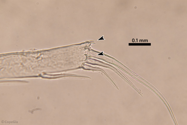 Caligus latigenitalisの第4胸脚末端