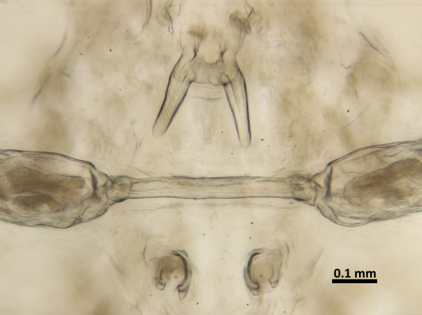 C. polycanthi 雄♂の胸部腹側