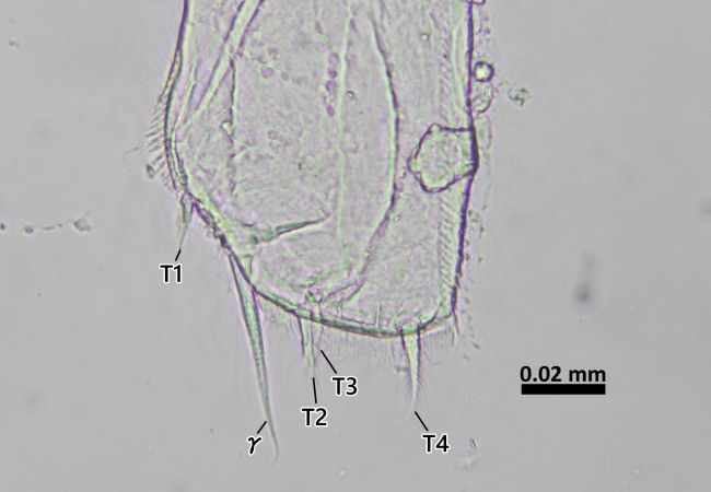 Porcellidium kiiroumの尾肢先端